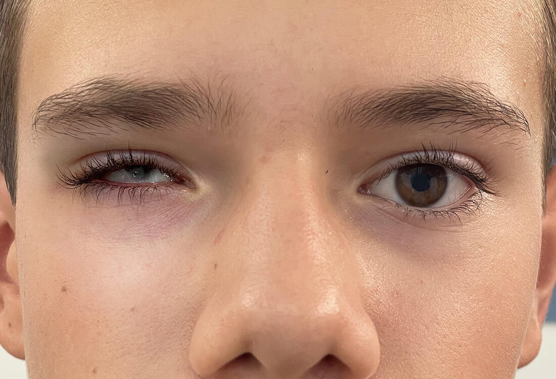 /