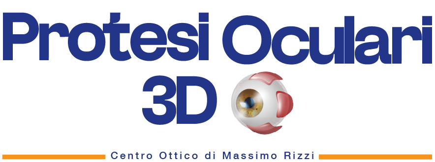 Protesi Oculari 3d
